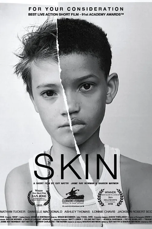 Skin