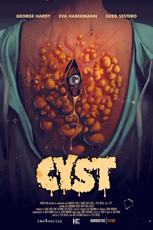 Cyst